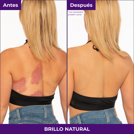 Wondere PerfectSkin Body Cover